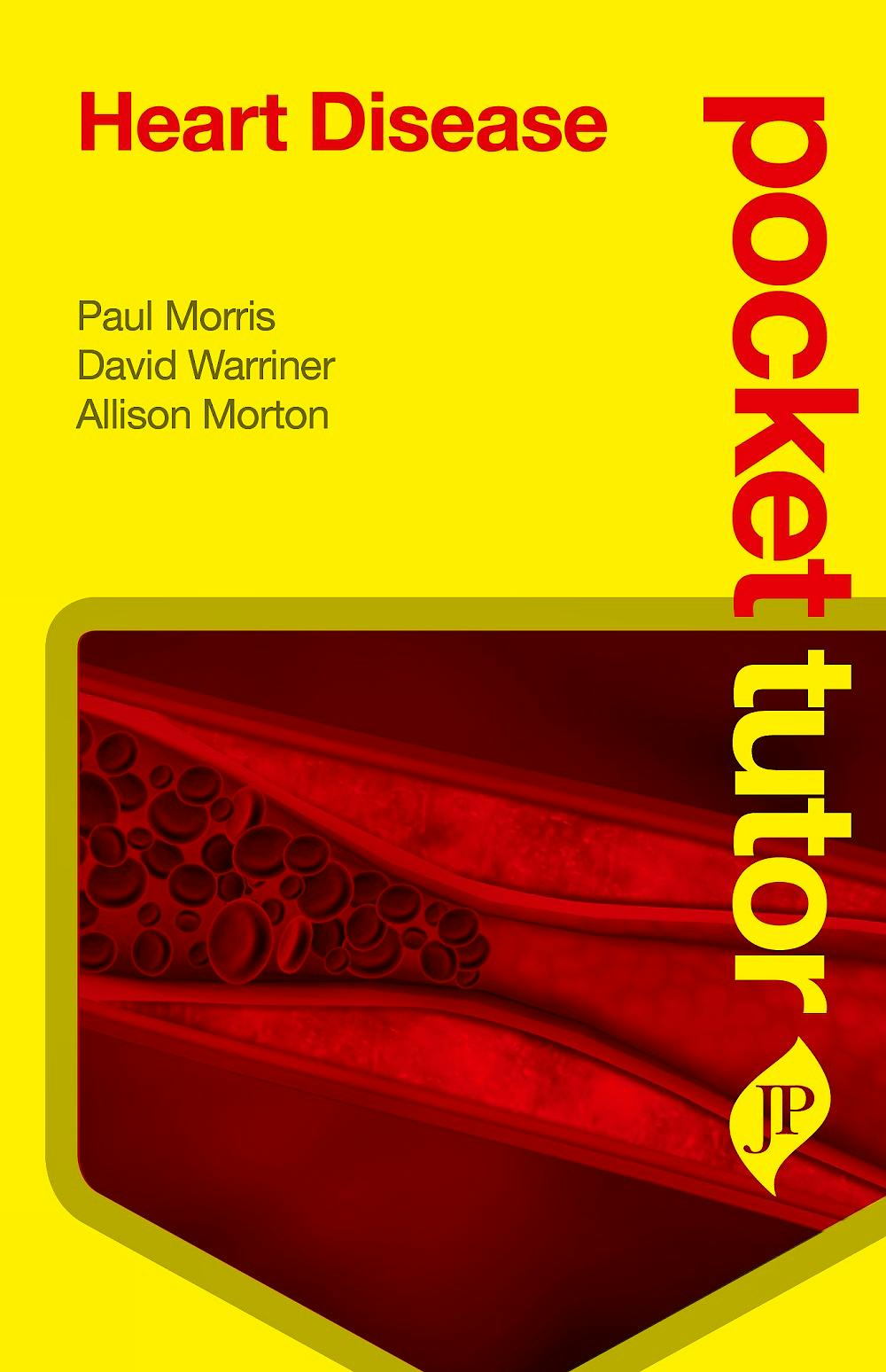 Portada del libro 9781909836327 Pocket Tutor Heart Disease