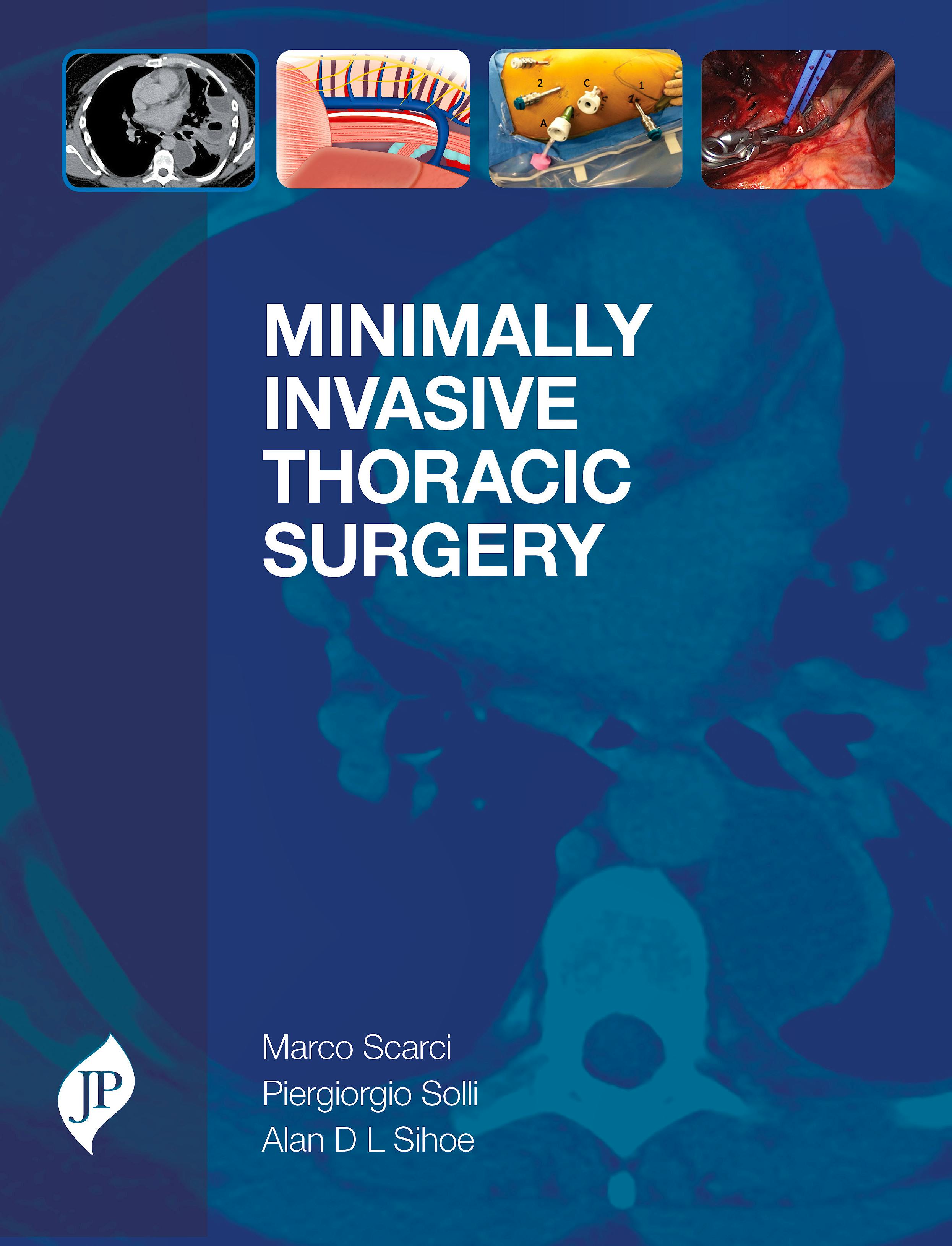 Portada del libro 9781909836402 Minimally Invasive Thoracic Surgery