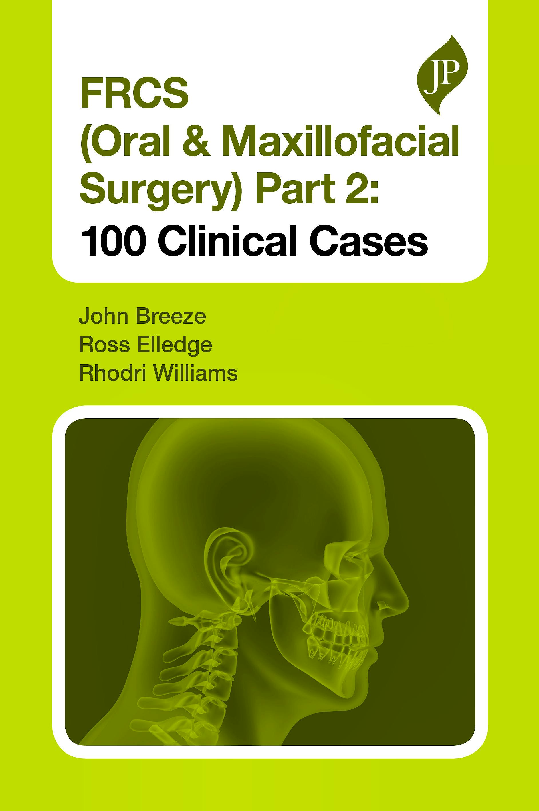 Portada del libro 9781909836839 FRCS (Oral & Maxillofacial Surgery) Part 2: 100 Clinical Cases