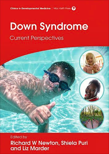 Portada del libro 9781909962477 Down Syndrome. Current Perspectives