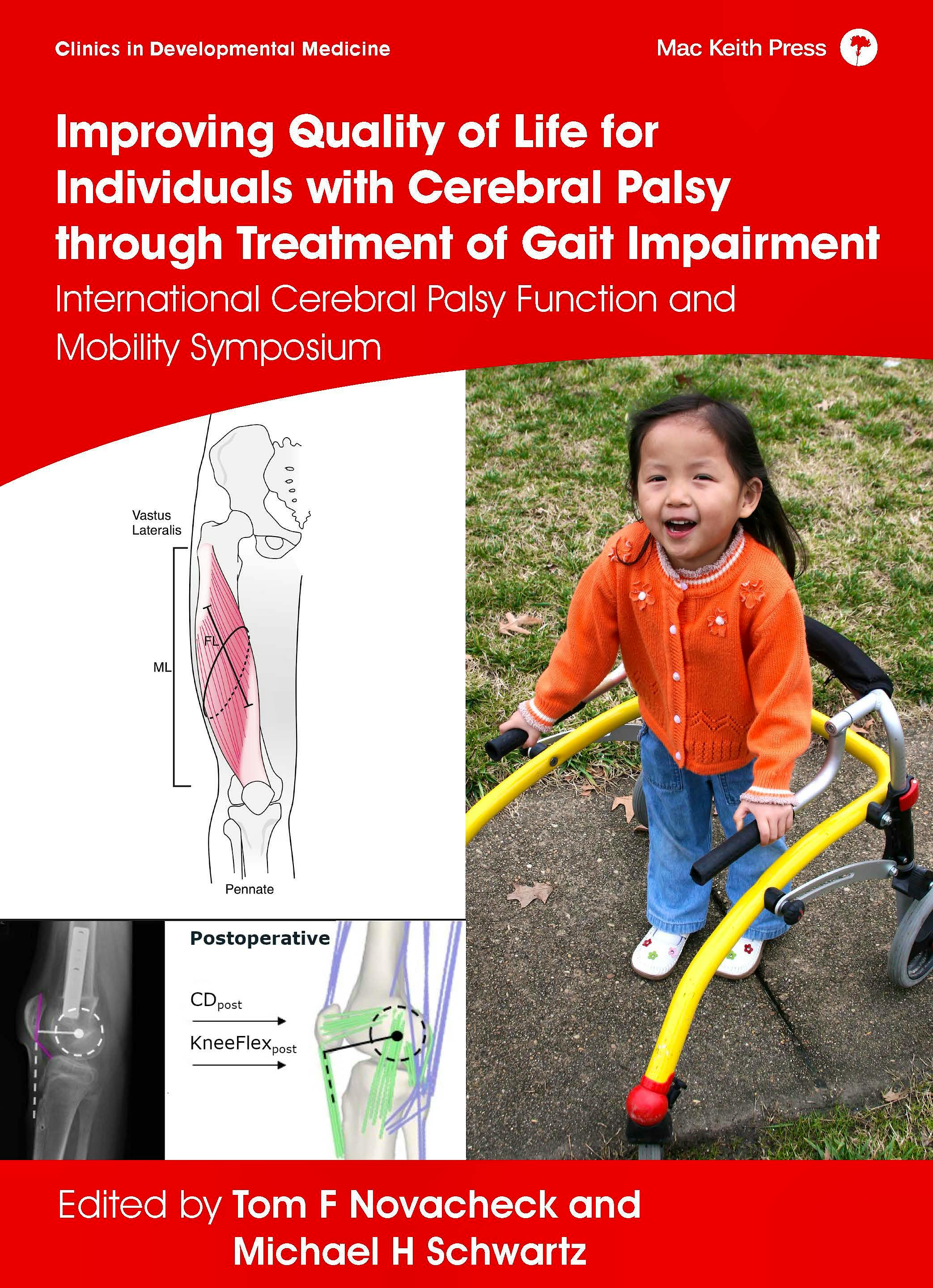 Portada del libro 9781911612414 Improving Quality of Life for Individuals with Cerebral Palsy through Treatment of Gait Impairment. International Cerebral Palsy Function and Mobility