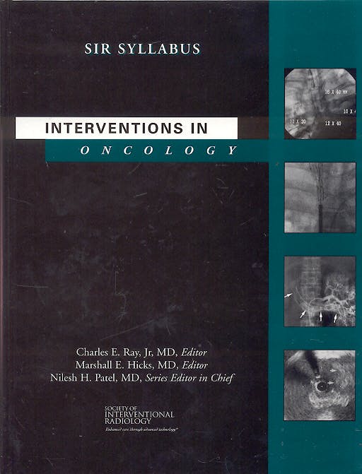 Portada del libro 9781928625094 Interventions in Oncology. Sir Syllabus