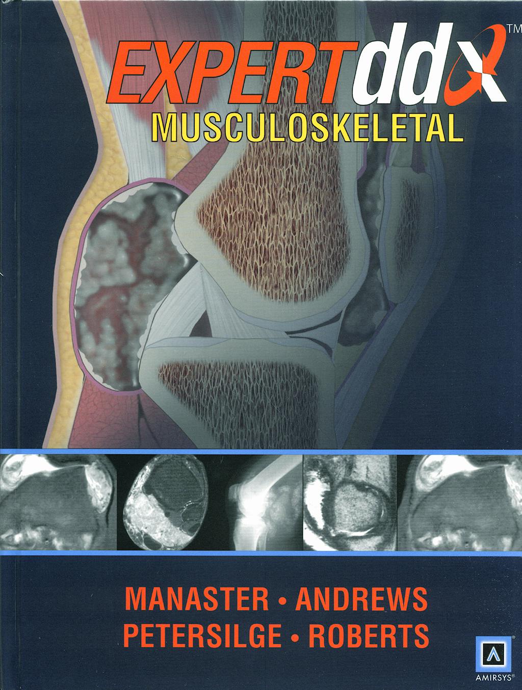 Portada del libro 9781931884037 Expert Ddx: Musculoskeletal