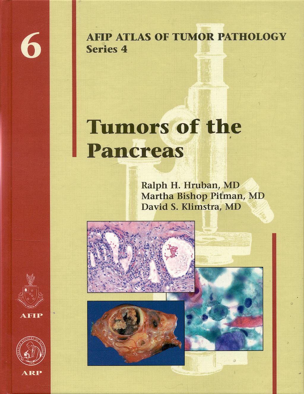 Portada del libro 9781933477022 Tumors of the Pancreas (AFIP Atlas of Tumor Pathology Series 4, Vol. 6)