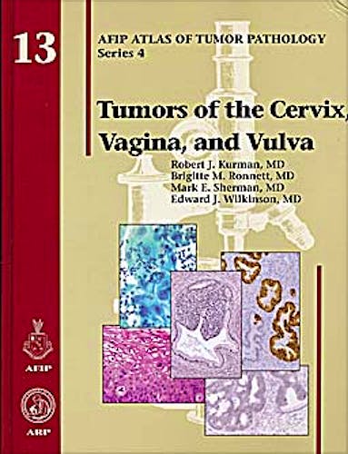 Portada del libro 9781933477114 Tumors of the Cervix, Vagina, and Vulva (AFIP Atlas of Tumor Pathology Series 4, Vol. 13)