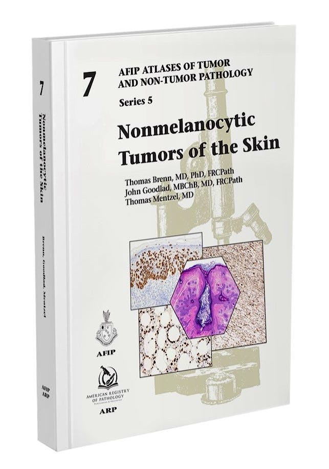 Nonmelanocytic Tumors of The Skin (AFIP Atlases of Tumor and Non