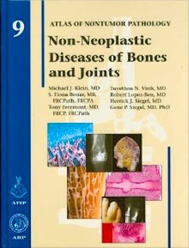 Portada del libro 9781933477169 Non-Neoplastic Diseases of Bones and Joints. AFIP Atlas of Nontumor Pathology, Vol. 9