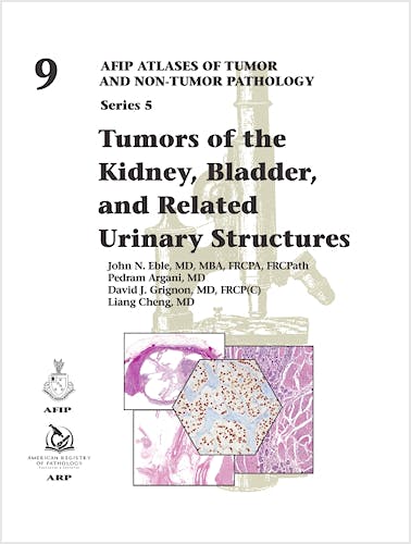 Portada del libro 9781933477176 Tumors of the Kidney, Bladder, and Related Urinary Structures (AFIP Atlases of Tumor and Non-Tumor Pathology, Series 5, Vol. 9)