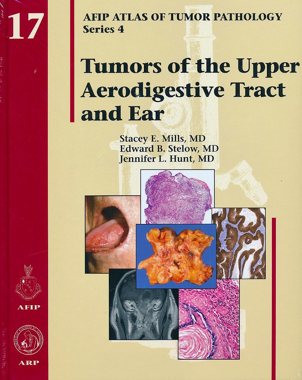 Portada del libro 9781933477206 Tumors of the Upper Aerodigestive Tract and Ear (AFIP Atlas of Tumor Pathology Series 4, Vol. 17)