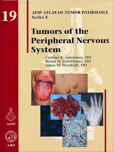 Portada del libro 9781933477305 Tumors of the Peripheral Nervous System (AFIP Atlas of Tumor Pathology Series 4, Vol. 19)