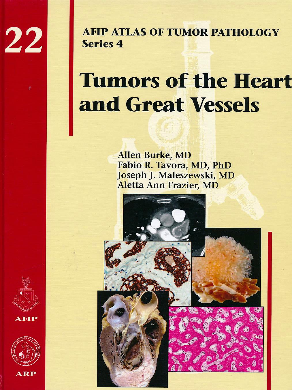 Portada del libro 9781933477336 Tumors of the Heart and Great Vessels (AFIP Atlas of Tumor Pathology Series 4, Vol. 22)