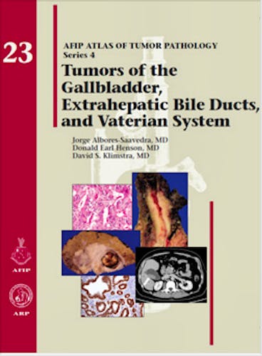 Portada del libro 9781933477343 Tumors of the Gallbladder, Extrahepatic Bile Ducts, and Vaterian System (AFIP Atlas of Tumor Pathology Series 4, Vol. 23)