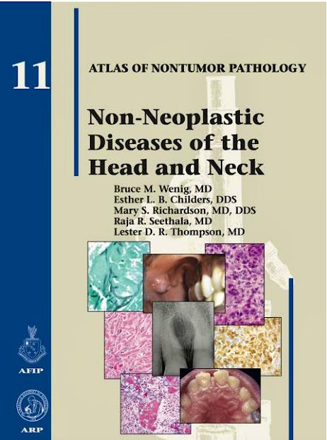 Non-Neoplastic Diseases of the Head and Neck. AFIP Atlas of