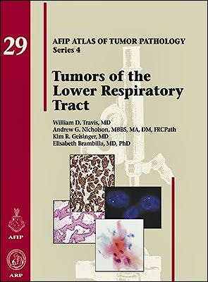 Portada del libro 9781933477466 Tumors of the Lower Respiratory Tract (AFIP Atlas of Tumor Pathology Series 4, Vol. 29)