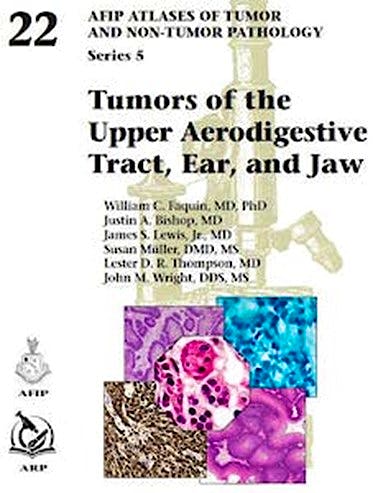 語学+参考書 Tumors of the Intestines (AFIP Atlas of Tumor Pathology Series 4) s-l400.jpg