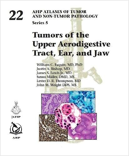 Portada del libro 9781933477619 Tumors of the Upper Aerodigestive Tract, Ear, and Jaw (AFIP Atlas of Tumor and Non-Tumor Pathology, Series 5, Vol. 22)