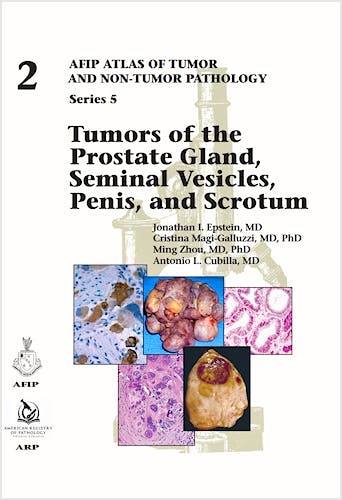 Portada del libro 9781933477909 Tumors of the Prostate Gland, Seminal Vesicles, Penis, and Scrotum (AFIP Atlas of Tumor and Non-tumor Pathology, Series 5, Vol. 2)