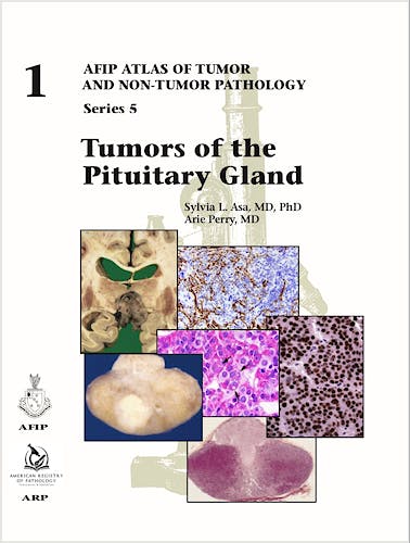 Portada del libro 9781933477916 Tumors of the Pituitary Gland (AFIP Atlas of Tumor and Non-Tumor Pathology Series 5, Vol. 1)