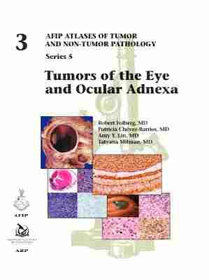 Portada del libro 9781933477923 Tumors of the Eye and Ocular Adnexa (AFIP Atlases of Tumor and Non-tumor Pathology, Series 5, Vol. 3)