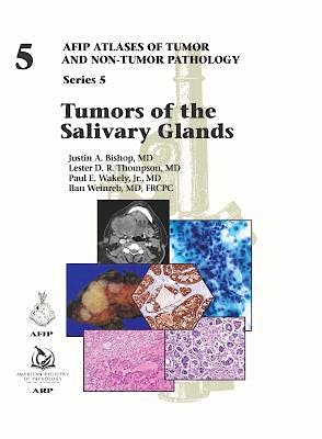 Portada del libro 9781933477947 Tumors of the Salivary Glands (AFIP Atlases of Tumor and Non-tumor Pathology, Series 5, Vol. 5)
