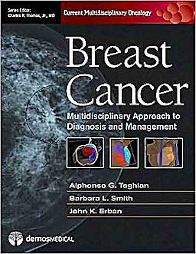 Portada del libro 9781933864440 Breast Cancer. a Multidisciplinary Approach to Diagnosis and Management