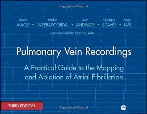 Portada del libro 9781935395041 Pulmonary Vein Recordings: A Practical Guide to the Mapping and Ablation of Atrial Fibrillation