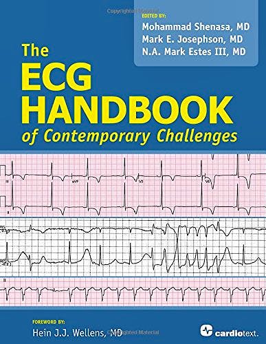 Portada del libro 9781935395881 Ecg Handbook of Contemporary Challenges