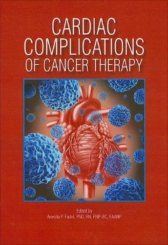 Portada del libro 9781935864240 Cardiac Complications of Cancer Therapy
