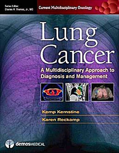 Portada del libro 9781936287062 Lung Cancer. a Multidisciplinary Approach to Diagnosis and Management