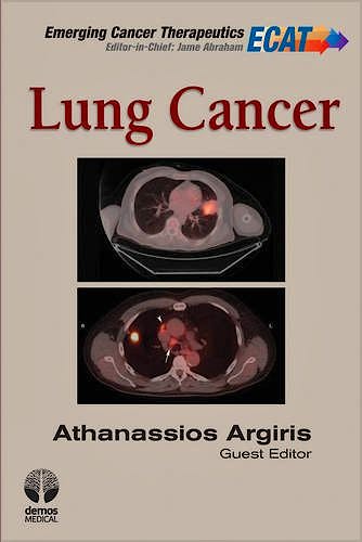 Portada del libro 9781936287529 Lung Cancer. Emerging Cancer Therapeutics