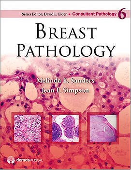Portada del libro 9781936287680 Breast Pathology (Consultant Pathology, Vol. 6)