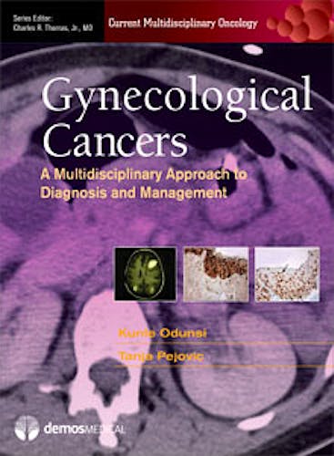 Portada del libro 9781936287895 Gynecologic Cancers. a Multidisciplinary Approach to Diagnosis and Management (Current Multidisciplinary Oncology)