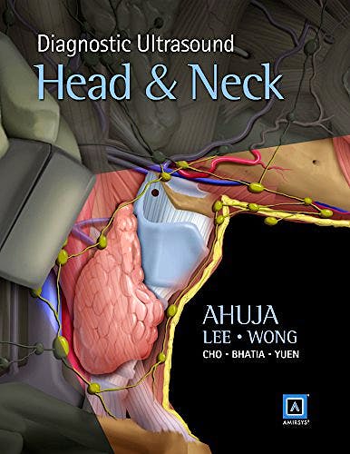 Portada del libro 9781937242169 Diagnostic Ultrasound: Head and Neck