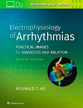 Portada del libro 9781975101107 Electrophysiology of Arrhythmias. Practical Images for Diagnosis and Ablation