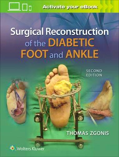 Surgical Reconstruction of the Diabetic Foot and Ankle