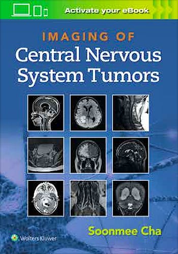 Portada del libro 9781975103743 Imaging of Central Nervous System Tumors