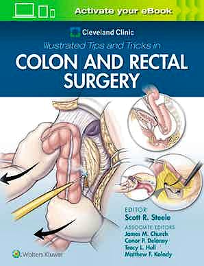 Portada del libro 9781975108250 Cleveland Clinic Illustrated Tips and Tricks in Colon and Rectal Surgery