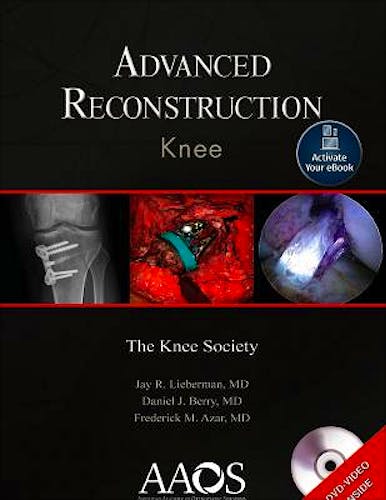 Portada del libro 9781975121747 Advanced Reconstruction. Knee