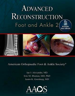 Portada del libro 9781975122676 Advanced Reconstruction. Foot and Ankle 2