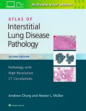 Portada del libro 9781975124670 Atlas of Interstitial Lung Disease Pathology. Pathology with High Resolution CT Correlations