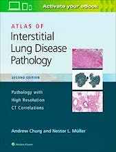 Atlas of Interstitial Lung Disease Pathology. Pathology with High Resolution CT Correlations