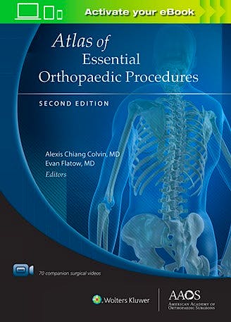 Portada del libro 9781975124861 Atlas of Essential Orthopaedic Procedures + Surgical Videos