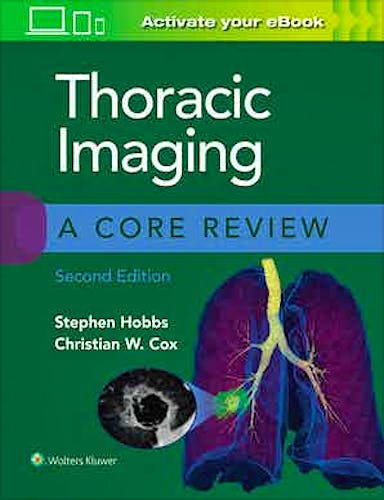 Portada del libro 9781975126223 Thoracic Imaging. A Core Review