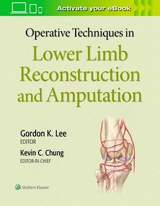 Portada del libro 9781975127343 Operative Techniques in Plastic Surgery. Lower Limb Surgery
