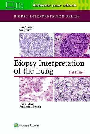 Portada del libro 9781975136581 Biopsy Interpretation of the Lung (Biopsy Interpretation Series)