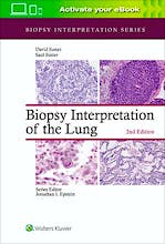 Biopsy Interpretation of the Lung (Biopsy Interpretation Series)