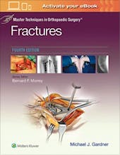 Master Techniques in Orthopaedic Surgery. Fractures