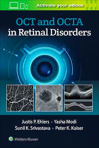 OCT and OCT Angiography in Retinal Disorders