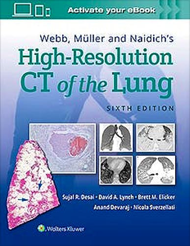 Portada del libro 9781975144432 Webb, Muller and Naidich's High-Resolution CT of the Lung