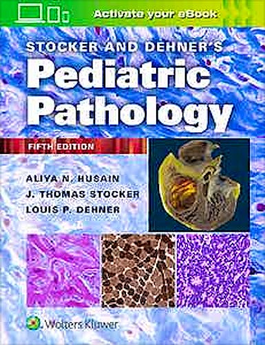 Portada del libro 9781975144814 STOCKER and DEHNER's Pediatric Pathology